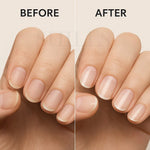 image, SHILLS Professional Nail Therapy 12-in-1 | Nail Growth & Repair Strengthener | Moisture Restore & Shine Booster – 15ml